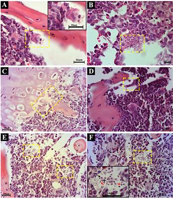 Oral Trypanosoma cruzi Acute Infection in Mice Targets Primary Lymphoid Organs and Triggers Extramedullary Hematopoiesis